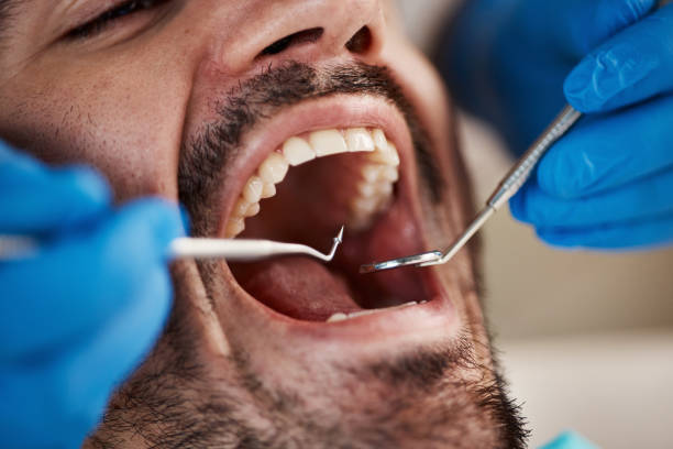 Best Walk-In Emergency Dental Services in Henderson, NC